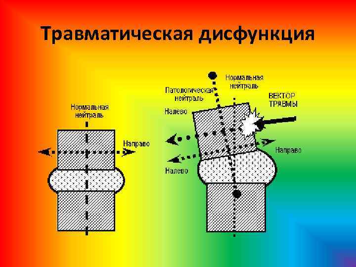 Травматическая дисфункция 