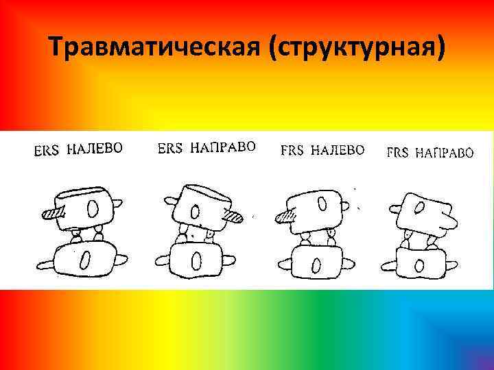 Травматическая (структурная) 