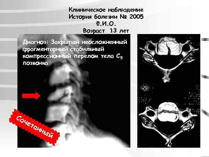 Клиническое наблюдение История болезни № 2005 Ф. И. О. Возраст 13 лет Диагноз: Закрытый