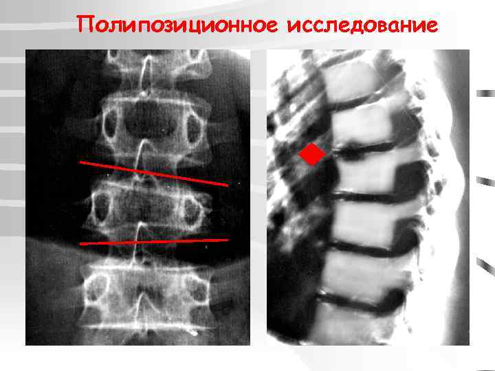Полипозиционное исследование 