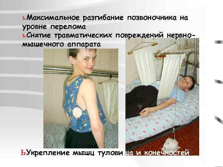 ь Максимальное разгибание позвоночника на уровне перелома ь Снятие травматических повреждений нервномышечного аппарата ь