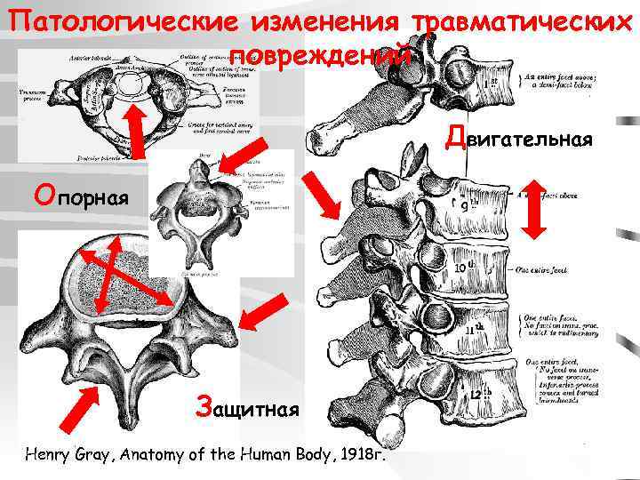 Патологические изменения травматических повреждений Двигательная Опорная Защитная Henry Gray, Anatomy of the Human Body,