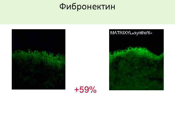Фибронектин MATRIXYL® synthe'6™ +59% 