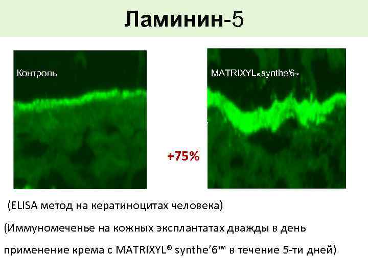 Ламинин-5 Контроль MATRIXYL® synthe'6™ +75% (ELISA метод на кератиноцитах человека) (Иммуномеченье на кожных эксплантатах