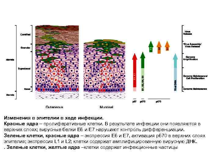 Изменения в эпителии в ходе инфекции. Красные ядра – пролиферативные клетки. В результате инфекции