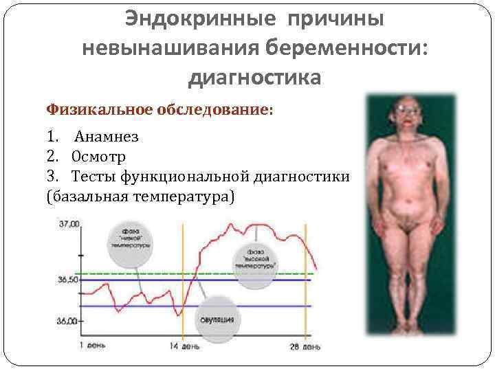 Эндокринные причины невынашивания беременности: диагностика Физикальное обследование: 1. Анамнез 2. Осмотр 3. Тесты функциональной