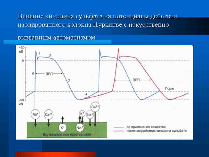 Влияние хинидина сульфата на потенциалы действия изолированного волокна Пуркинье с искусственно вызванным автоматизмом 