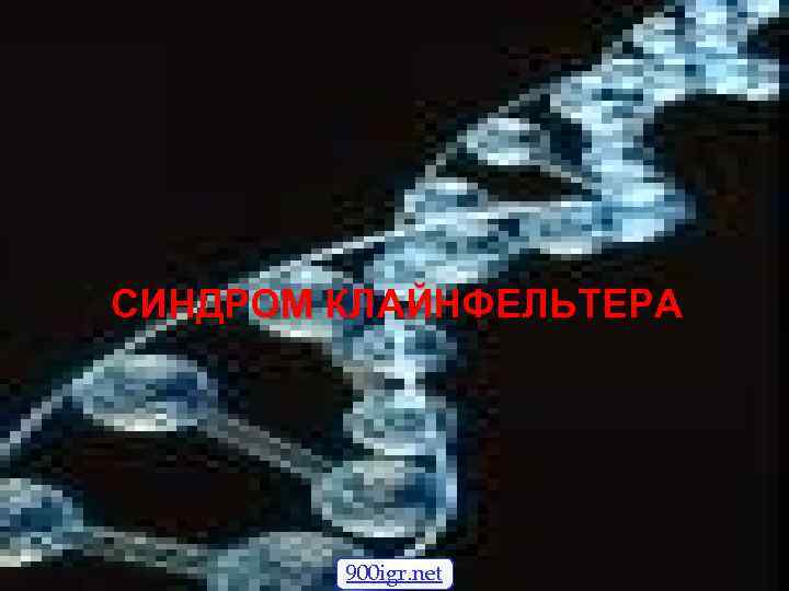 СИНДРОМ КЛАЙНФЕЛЬТЕРА 900 igr. net 