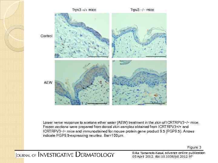 Lower nerve response to acetone ether water (AEW) treatment in the skin of ICRTRPV