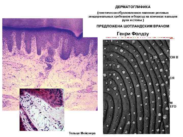 ДЕРМАТОГЛИФИКА ДЕРМА (генетически обусловленное явление роговых эпидермальных гребешков и борозд на кончиках пальцев руки