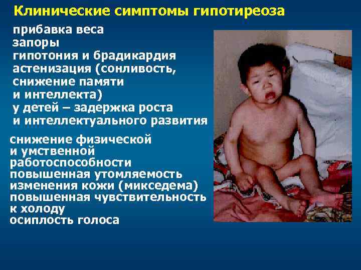 Клинические симптомы гипотиреоза прибавка веса запоры гипотония и брадикардия астенизация (сонливость, снижение памяти и