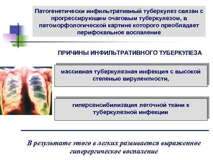 Патогенетически инфильтративный туберкулез связан с прогрессирующим очаговым туберкулезом, в патоморфологической картине которого преобладает перифокальное