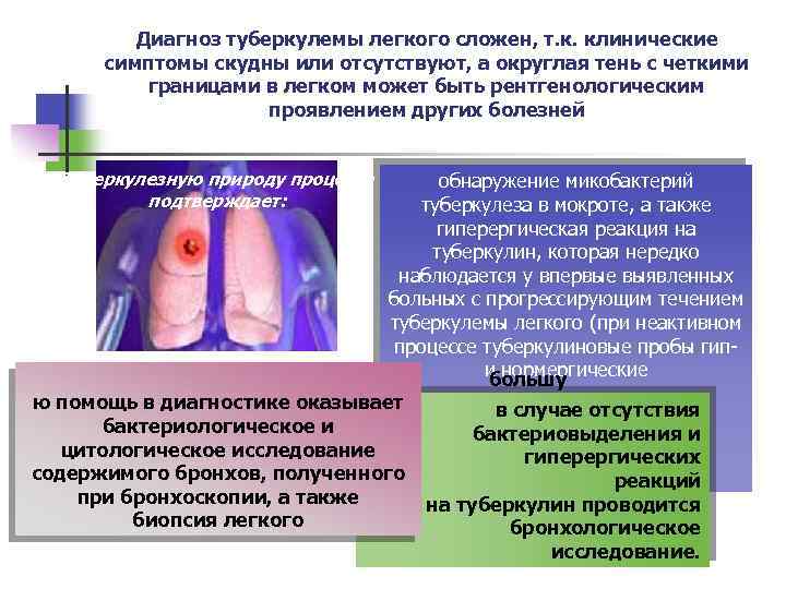 Диагноз туберкулемы легкого сложен, т. к. клинические симптомы скудны или отсутствуют, а округлая тень