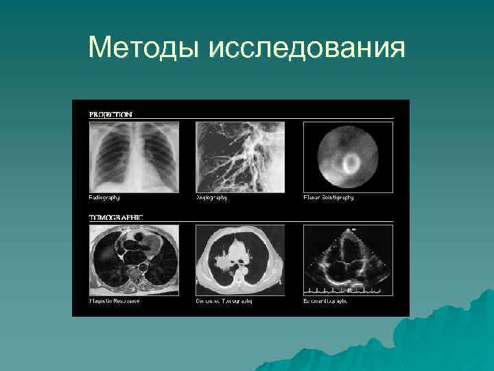 Методы исследования 