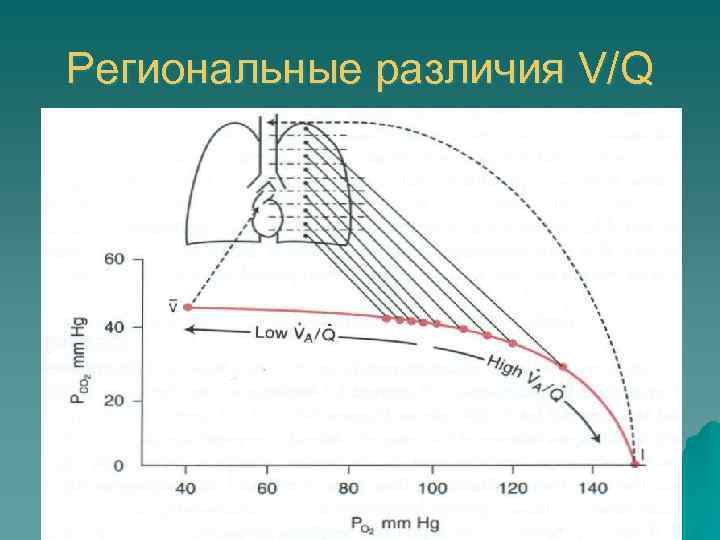 Региональные различия V/Q 