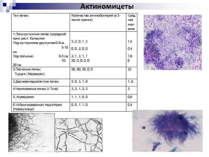 Актиномицеты Тип почвы Количество актинобактерий (в 5 полях зрения) Сред нее знач ение 3