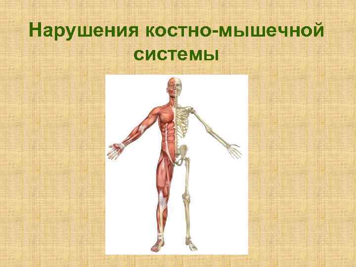 Нарушения костно мышечной системы 