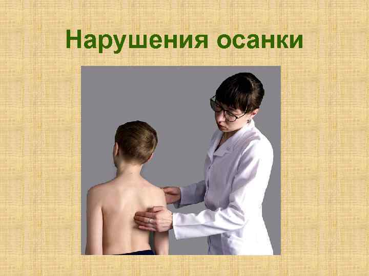 Нарушения осанки 