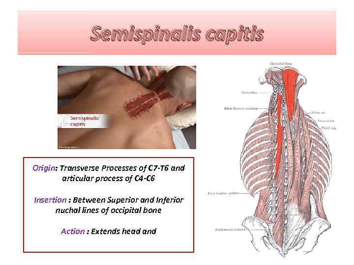 Semispinalis capitis Origin: Transverse Processes of C 7 -T 6 and articular process of