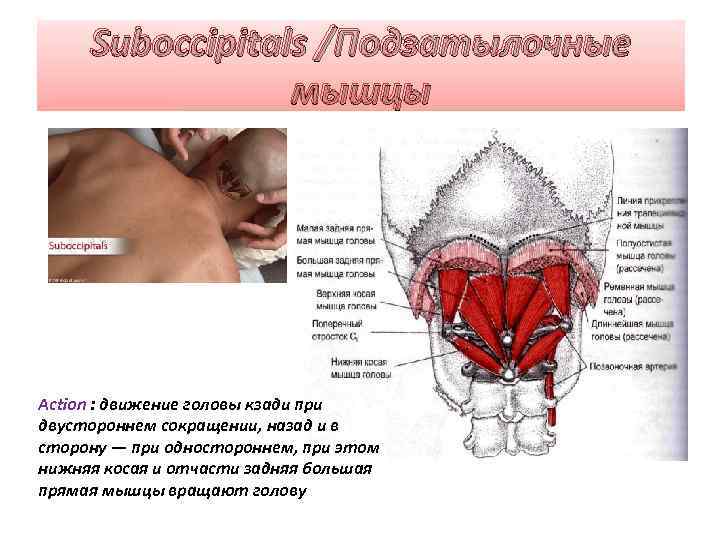 Suboccipitals /Подзатылочные мышцы Action : движение головы кзади при двустороннем сокращении, назад и в