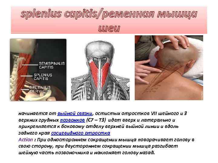 splenius capitis/ременная мышца шеи начинается от выйной связки, остистых отростков VII шейного и 3