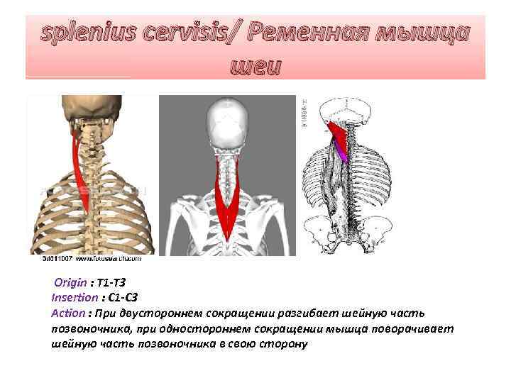 splenius cervisis/ Ременная мышца шеи Origin : T 1 -T 3 Insertion : C