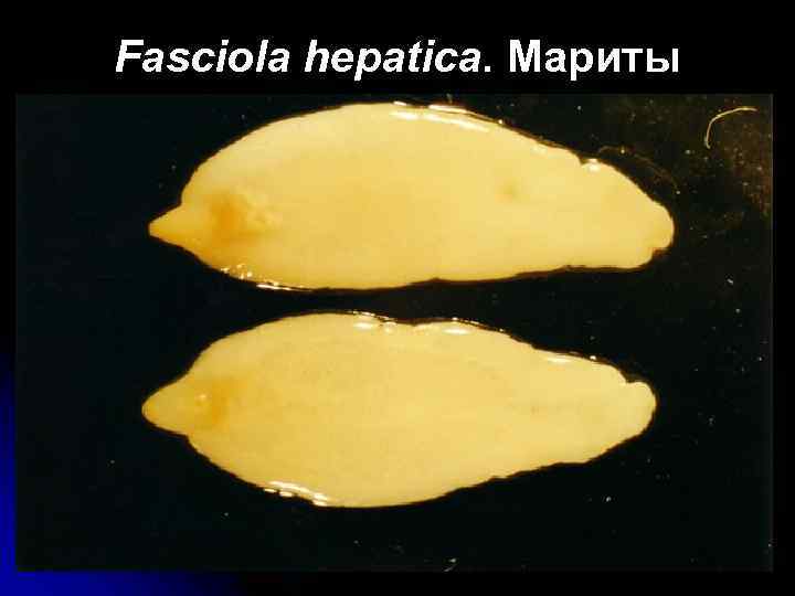 Fasciola hepatica. Мариты 