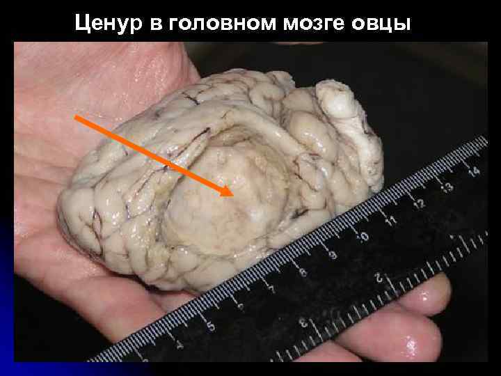 Ценур в головном мозге овцы 