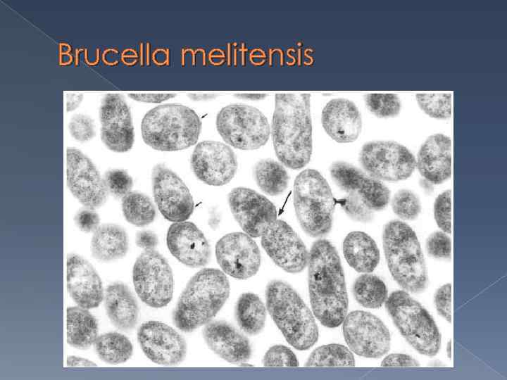 Brucella melitensis 