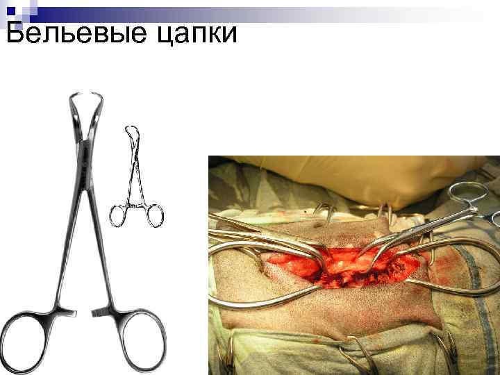 Бельевые цапки 