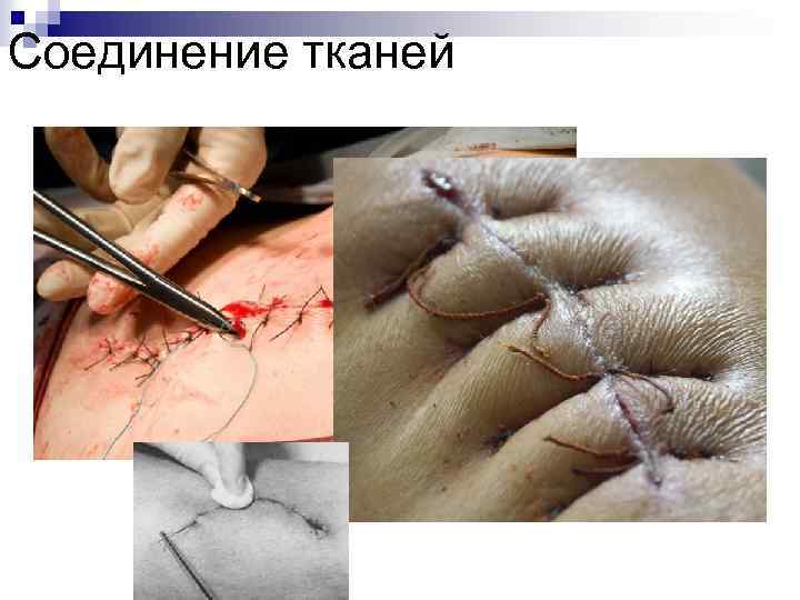 Соединение тканей 