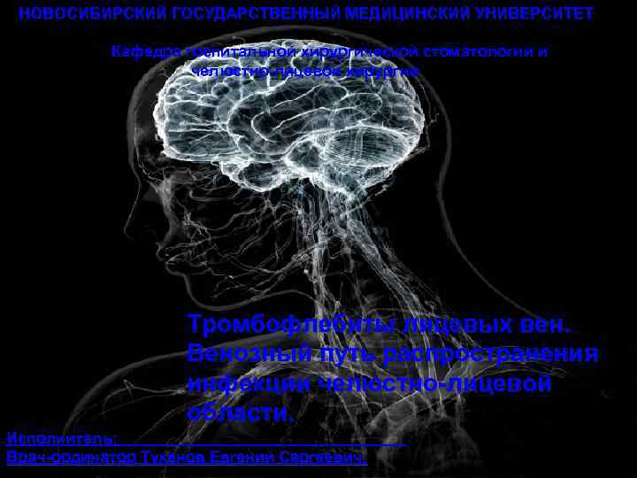 НОВОСИБИРСКИЙ ГОСУДАРСТВЕННЫЙ МЕДИЦИНСКИЙ УНИВЕРСИТЕТ Кафедра госпитальной хирургической стоматологии и челюстно-лицевой хирургии Тромбофлебиты лицевых вен.