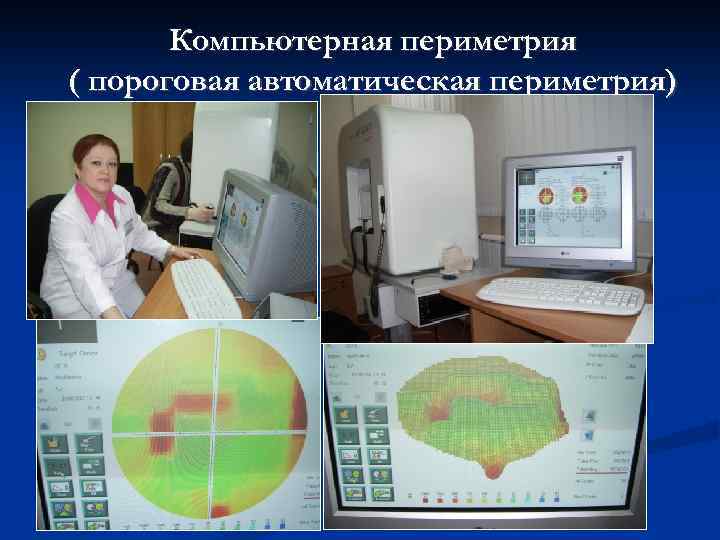 Периметрия в офтальмологии