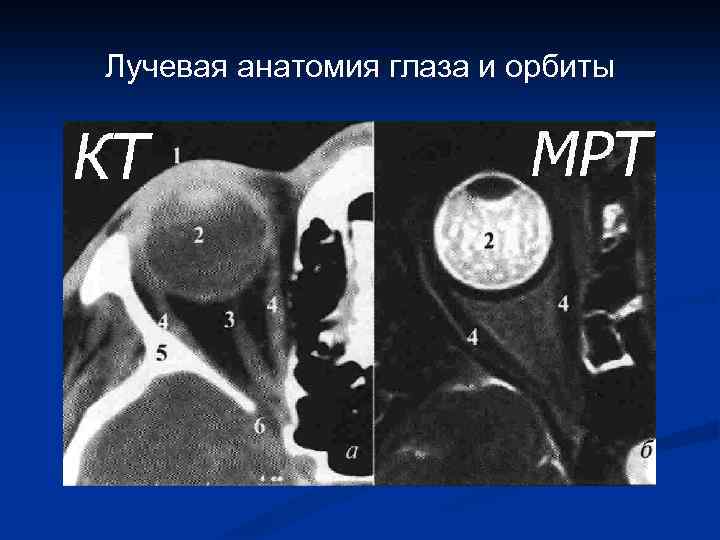 Лучевая диагностика в оториноларингологии и офтальмологии презентация