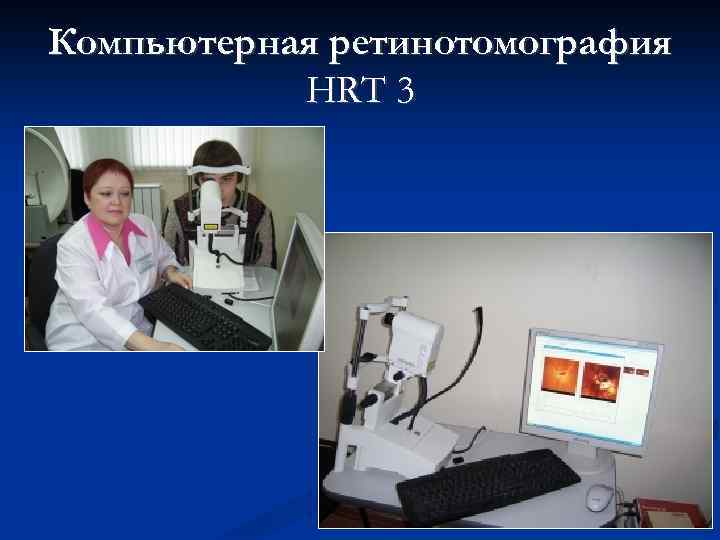 Компьютерная ретинотомография HRT 3 