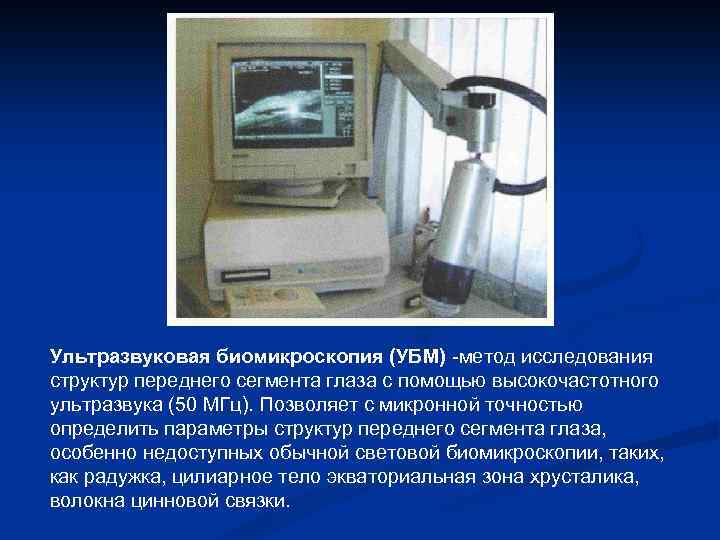 Ультразвуковая биомикроскопия (УБМ) -метод исследования структур переднего сегмента глаза с помощью высокочастотного ультразвука (50
