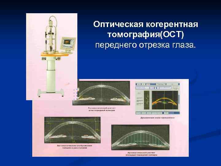 Оптическая когерентная томография схема