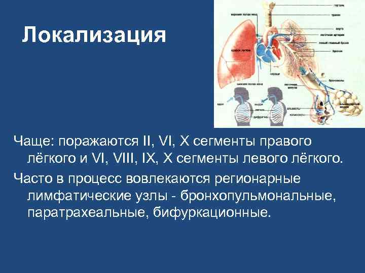 Локализация Чаще: поражаются II, VI, X сегменты правого лёгкого и VI, VIII, IX, X