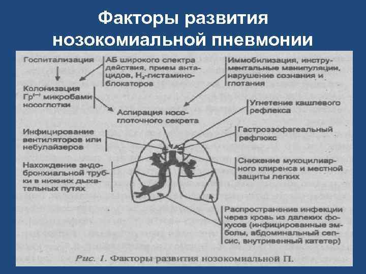 Факторы развития нозокомиальной пневмонии 