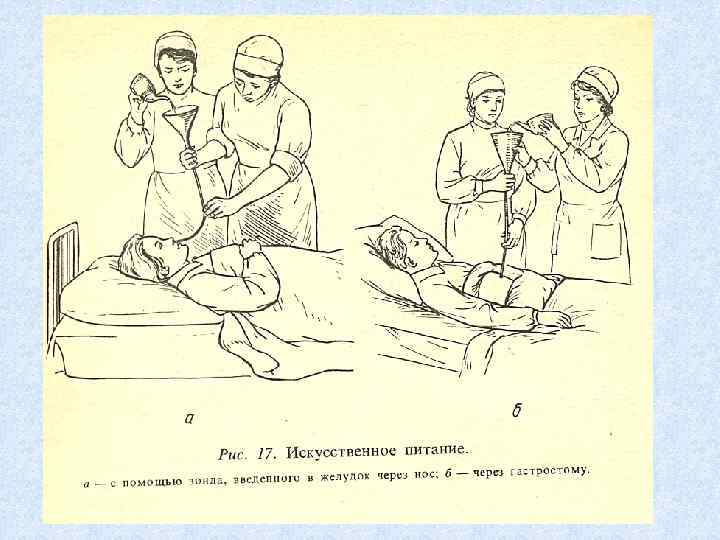 Питание через. Искусственное питание больных. Искусственное кормление пациента. Естественное и искусственное кормление пациента. Показания к искусственному питанию пациента.