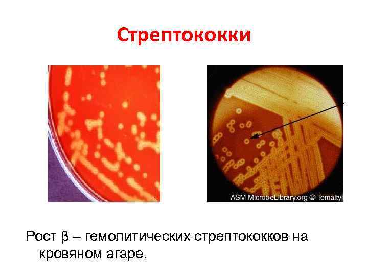 Стрептококки Рост β – гемолитических стрептококков на кровяном агаре. 