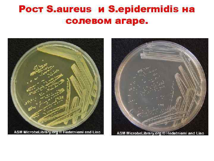 Staphylococcus aureus среда. Солевой агар для стафилококков. Молочно-солевой агар для стафилококков. Стафилококк ауреус на ЖСА. Золотистый стафилококк на среде ЖСА.