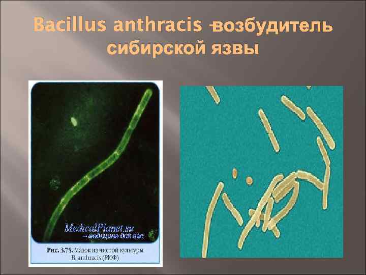 возбудитель Bacillus anthracis – сибирской язвы 