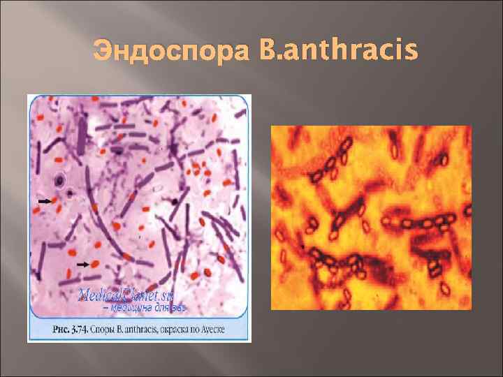 Эндоспора B. anthracis 