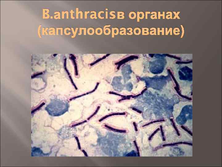 B. аnthracisв органах (капсулообразование) 