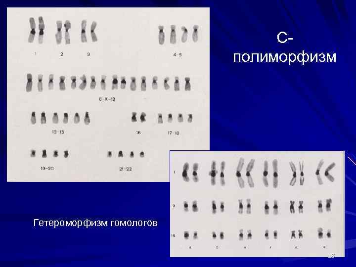 В кариотипе осла 62. Кариотип. Кариотип овцы. Гетероморфизм бактерий. Кариотип это в биологии.