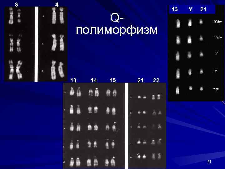 3 4 Qполиморфизм 13 14 15 21 13 Y 21 22 31 