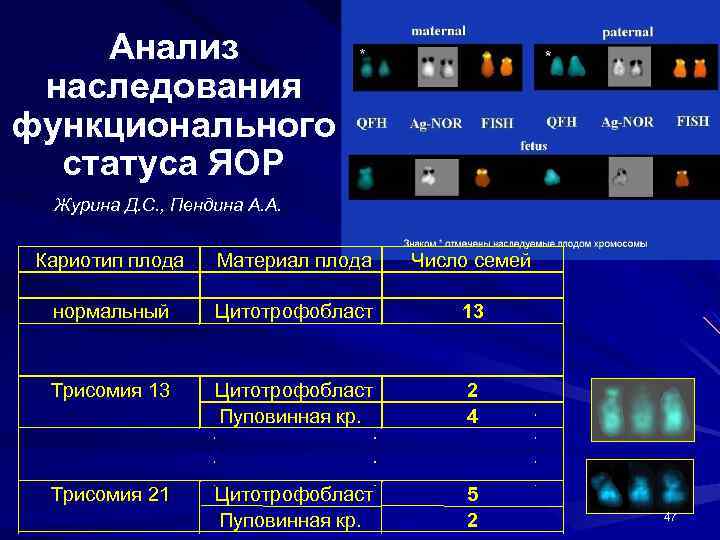 Анализ наследования функционального статуса ЯОР Журина Д. С. , Пендина А. А. Кариотип плода