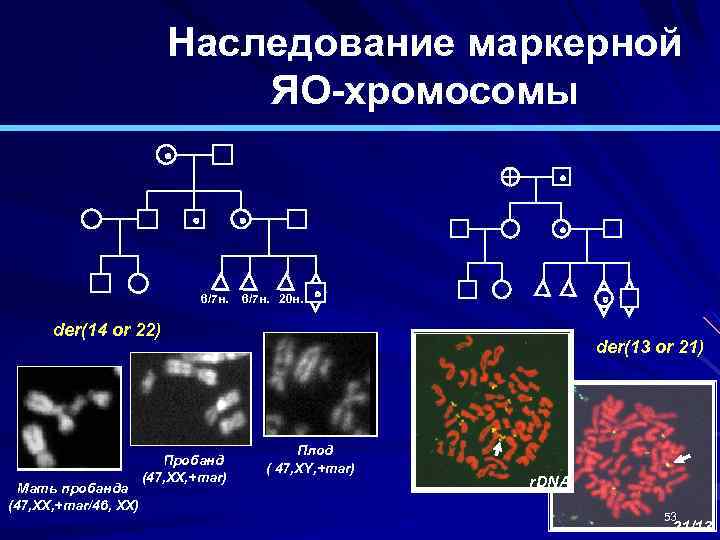 Наследование маркерной ЯО-хромосомы ! 6/7 н. 20 н. der(14 or 22) Мать пробанда (47,