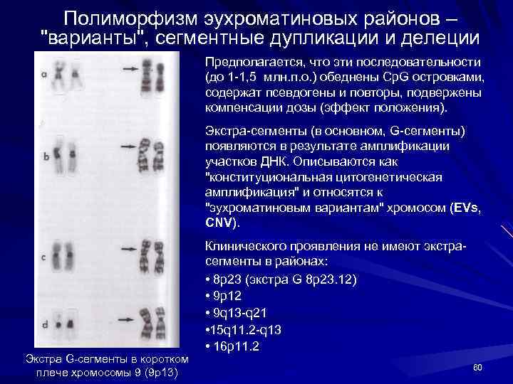 Полиморфизм эухроматиновых районов – 